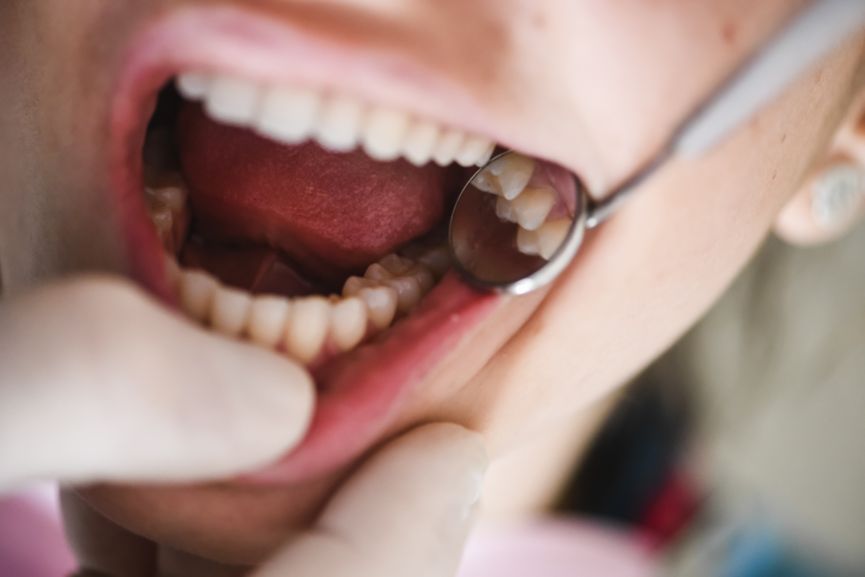 Odontología conservadora y periodoncia